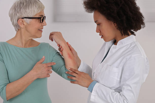 Eczema Treatment: Comprehensive Guide to Managing Atopic Dermatitis