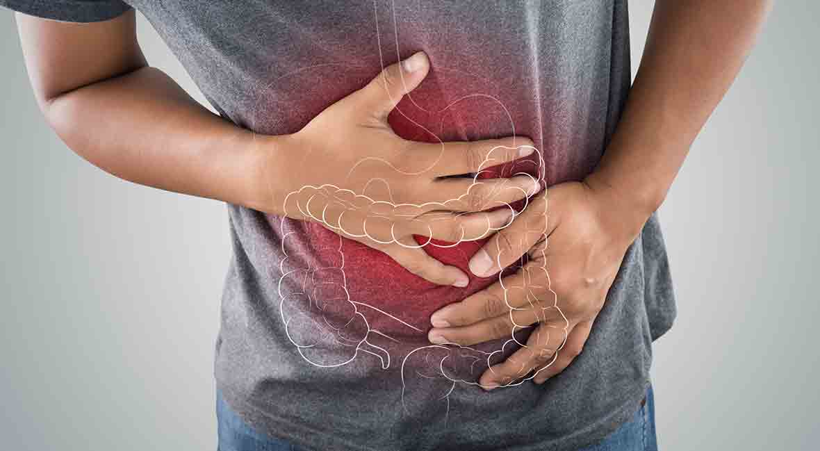 Ulcerative Colitis: Understanding Symptoms, Causes, and Treatment Options