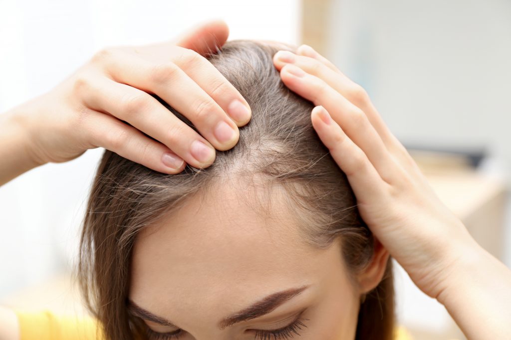Understanding Litfulo for Alopecia Areata: Treatment, Use, and What to Expect
