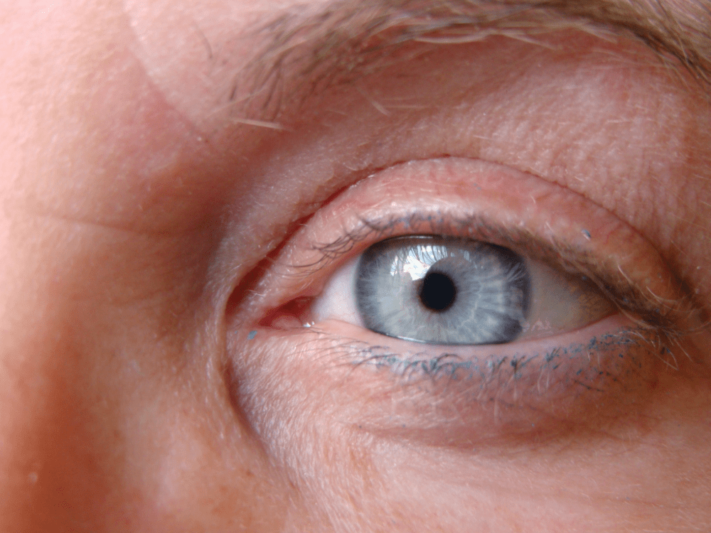 Macular Degeneration Treatment Options: Your Guide to Protecting Your Vision