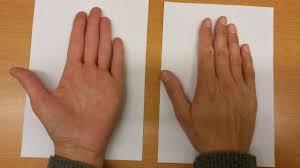 Addison’s Disease: Symptoms, Causes, and Living Well