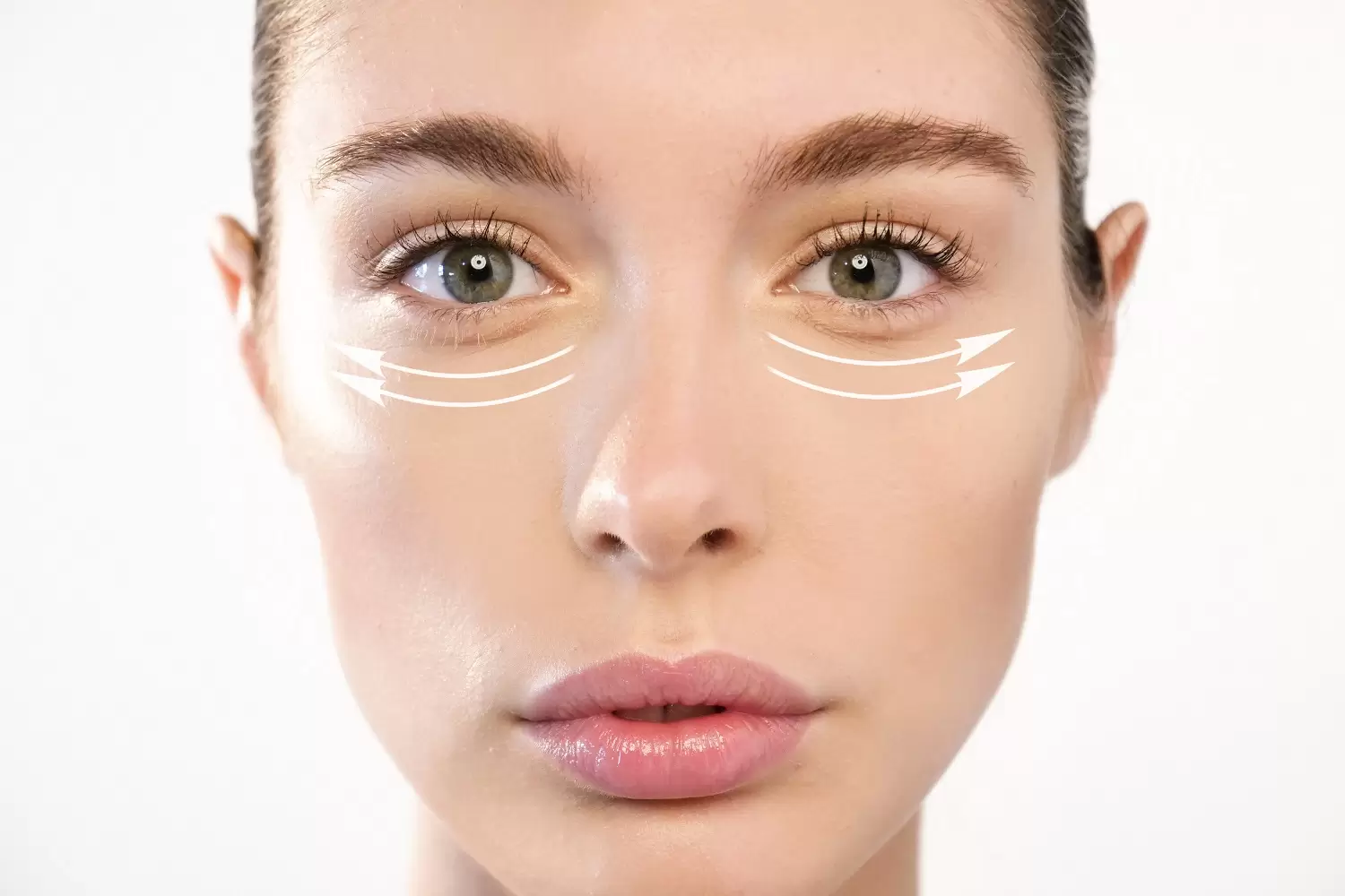 Eye Bags: Understanding Your Treatment Options