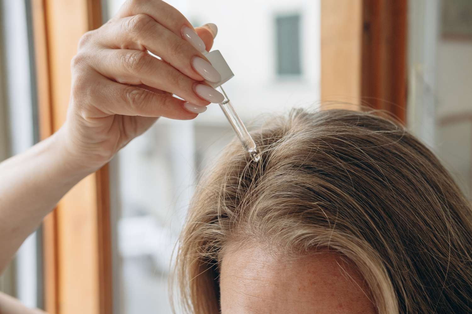 Home Remedies for Dandruff